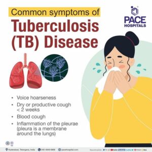 CommonsymptomsofTuberculosisTB 640w 2